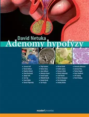 Medicína - ostatné Adenomy hypofýzy - David Netuka