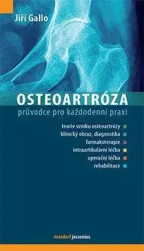 Medicína - ostatné Osteoartróza - Jiří Gallo