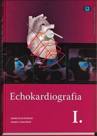 Medicína - ostatné Echokardiografia I. - Ingrid Schusterová