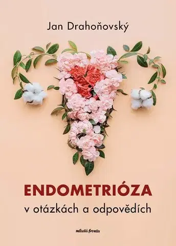 Gynekológia a pôrodníctvo Endometrióza v otázkách a odpovědích - Jan Drahoňovský