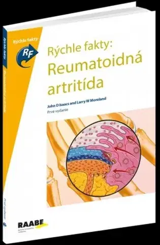Medicína - ostatné Rýchle fakty: Reumatoidná artritída - Kolektív autorov