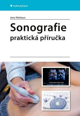 Medicína - ostatné Sonografie - praktická příručka - Jens Niehaus