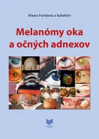 Medicína - ostatné Melanómy oka a očných adnexov - Kolektív autorov,Alena Furdová