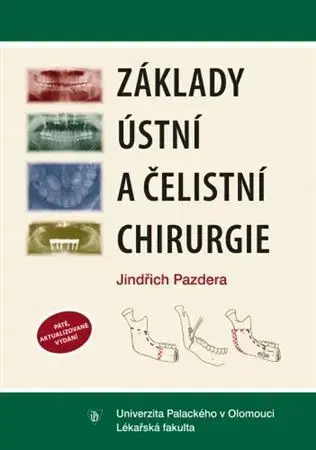 Stomatológia Základy ústní a čelistní chirurgie - Jindřich Pazdera