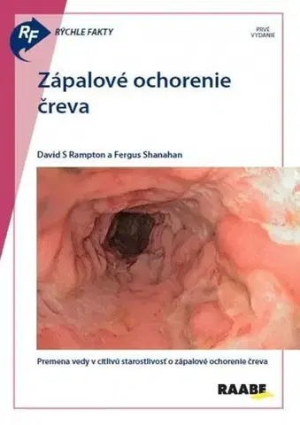 Medicína - ostatné Rýchle fakty: Zápalové ochorenie čreva - Kolektív autorov