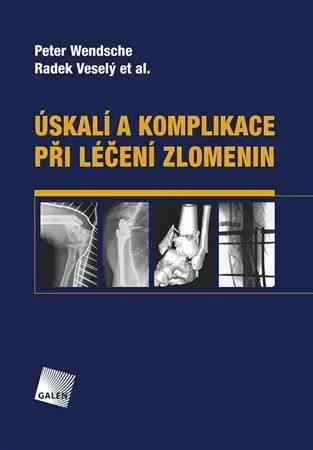 Chirurgia, ortopédia, traumatológia Úskalí a komplikace při léčení zlomenin - Peter Wendsche,Radek Veselý