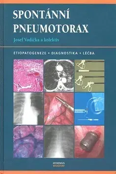 Medicína - ostatné Spontánní pneumotorax - Josef Vodička