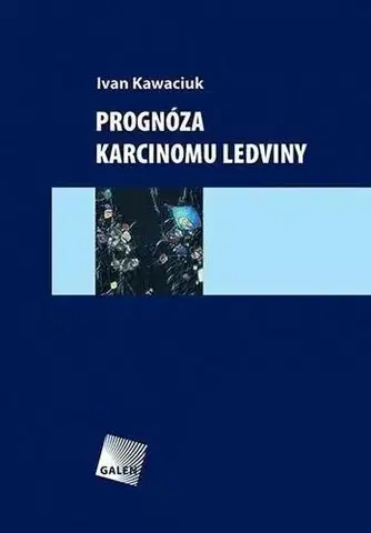 Medicína - ostatné Prognóza karcinomu ledviny - Ivan Kawaciuk