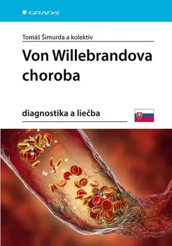 Medicína - ostatné Von Willebrandova choroba. Diagnostika a liečba - Tomáš Šimurda