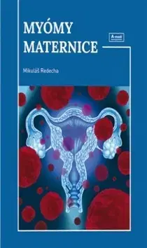Gynekológia a pôrodníctvo Myómy maternice - Mikuláš Redecha