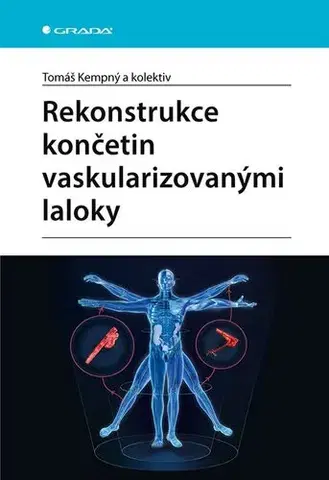 Chirurgia, ortopédia, traumatológia Rekonstrukce končetin vaskularizovanými laloky - Tomáš Kempný,Kolektív autorov