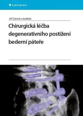 Chirurgia, ortopédia, traumatológia Chirurgická léčba degenerativního postižení bederní páteře - Kolektív autorov,Jiří Šrámek