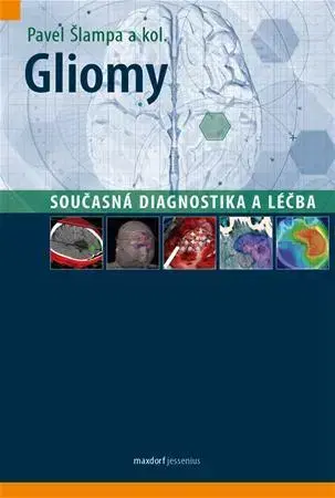 Medicína - ostatné Gliomy - současná diagnostika a léčba - Pavel Šlampa