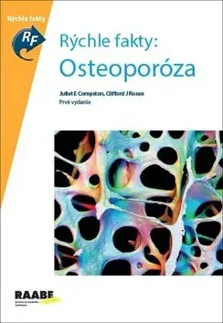 Medicína - ostatné Rýchle fakty: Osteoporóza - Kolektív autorov