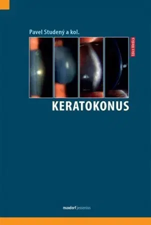 Medicína - ostatné Keratokonus - Pavel Studený,Kolektív autorov