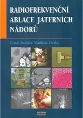 Medicína - ostatné Radifrekvenční ablace jaterních nádoru - Vladislav Třeška
