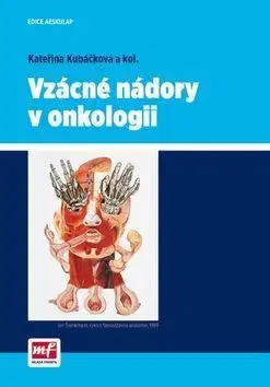 Medicína - ostatné Vzácné nádory v onkologii - Kateřina Kubáčková