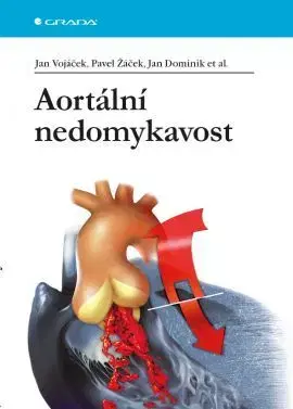 Medicína - ostatné Aortální nedomykavost - Kolektív autorov