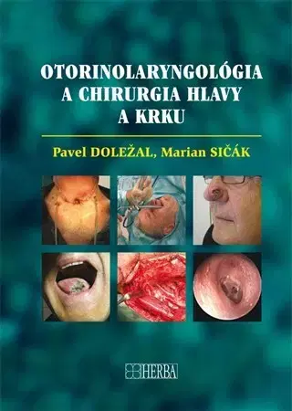 Medicína - ostatné Otorinolaryngológia a chirurgia hlavy a krku - Pavel Doležal,Marián Sičák