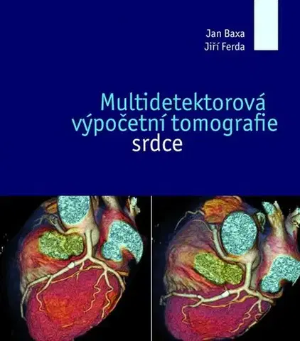 Medicína - ostatné Multidetektorová výpočetní tomografie srdce - Jan Baxa,Jiří Ferda