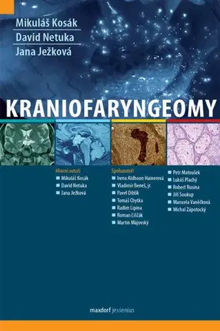 Medicína - ostatné Kraniofaryngeomy - David Netuka,Mikuláš Kosák,Jana Ježková