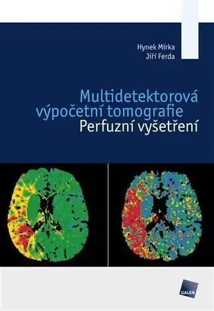 Medicína Multidetektorová výpočetní tomografie - Jiří Ferda,Hynek Mírka
