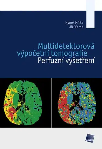 Medicína - ostatné Multidetektorová výpočetní tomografie - Hynek Mírka,Jiří Ferda