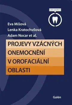 Stomatológia Projevy vzácných onemocnění v orofaciální oblasti - Eva Míšová,Lenka Kratochvílová,Adam Nocar