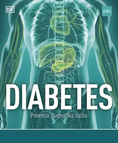 Medicína - ostatné Diabetes: Prevencia, diagnostika, liečba - Rosemary Walker,Zora Ličková