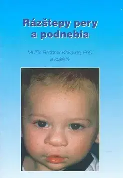 Medicína - ostatné Rázštepy pery a podnebia - Radomír Kokavec