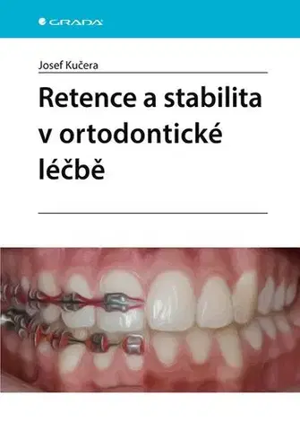 Stomatológia Retence a stabilita v ortodontické léčbě - Josef Kučera