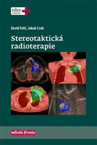 Medicína - ostatné Stereotaktická radioterapie - Feltl David,Jakub Cvek