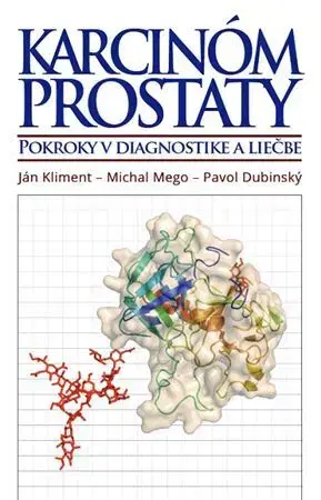 Onkológia Karcinóm prostaty - Ján Kliment,Michal Mego,Pavol Dubinský