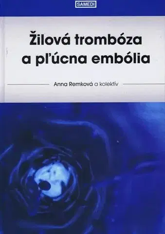 Medicína - ostatné Žilová trombóza a pľúcna embólia - Anna Remková,Kolektív autorov