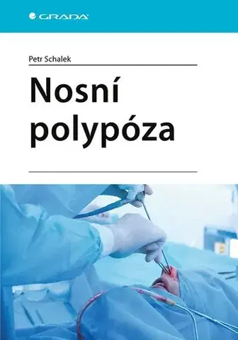 Medicína Nosní polypóza - Petr Schalek