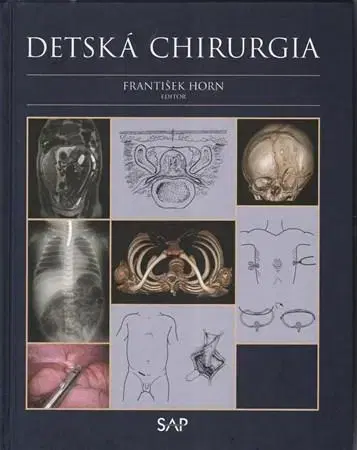 Pediatria Detská chirurgia - František Horn