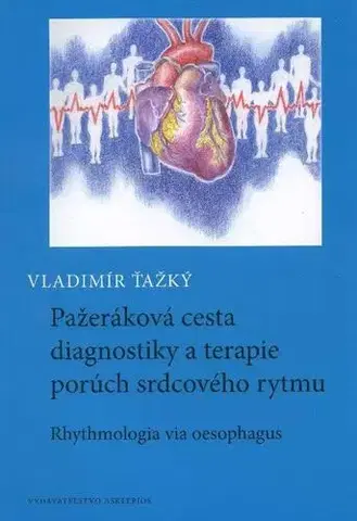 Medicína - ostatné Pažeráková cesta diagnostiky a terapie porúch srdcového rytmu - Vladimír Ťažký