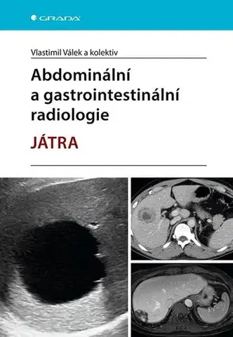 Medicína - ostatné Abdominální a gastrointestinální radiologie - Játra - Vlastimil Válek,Kolektív autorov