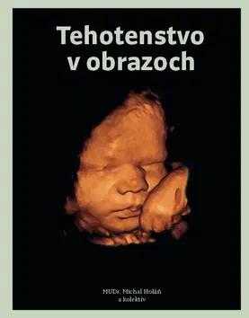 Tehotenstvo a pôrod Tehotenstvo v obrazoch - MUDr. Michal Holáň,Kolektív autorov