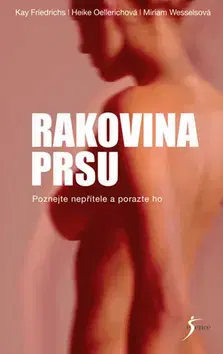 Onkológia Rakovina prsu - Heike Oellerich,Kolektív autorov