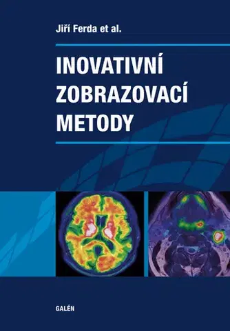Medicína - ostatné Inovativní zobrazovací metody - Jiří Ferda