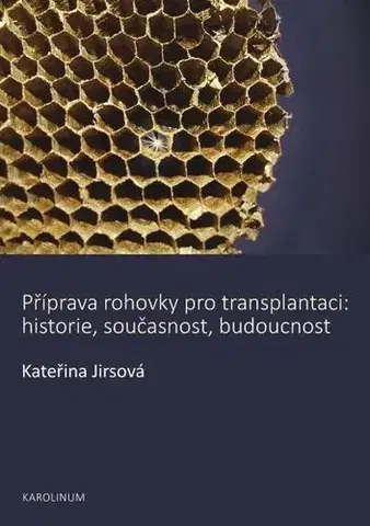 Medicína - ostatné Příprava rohovky pro transplantaci - Kateřina Jirsová
