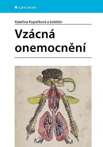 Medicína - ostatné Vzácná onemocnění - Kateřina Kopečková,Kolektív autorov