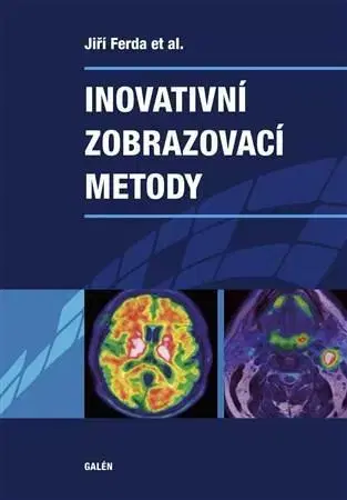 Medicína Inovativní zobrazovací metody - Jiří Ferda