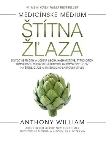 Medicína - ostatné Štítna žľaza - Anthony William