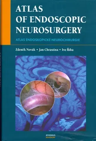 Chirurgia, ortopédia, traumatológia Atlas endoskopické neurochirurgie - Pavel Chrastina,Zdeněk Novák,Ivo Říha