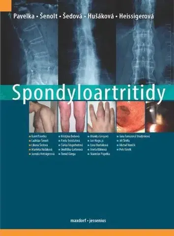 Medicína - ostatné Spondyloartritidy - Kolektív autorov,Karel Pavelka,Ladislav Šenolt