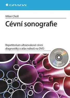 Medicína - ostatné Cévní sonografie + DVD - Milan Cholt