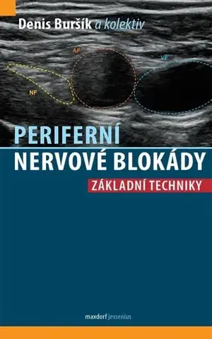 Medicína - ostatné Periferní nervové blokády - Denis Buršík