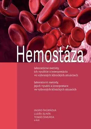 Medicína - ostatné Hemostáza, laboratorní metody, jejich využití a interpretace ve vybraných klinických situacích (3.vy - Ingrid Škorňová,Luděk Slavík,Tomáš Šimurda